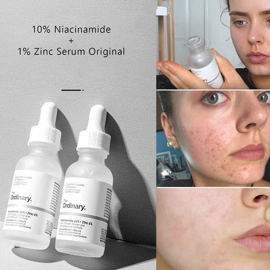The Ordinary Niacinamide  Serum 30ml